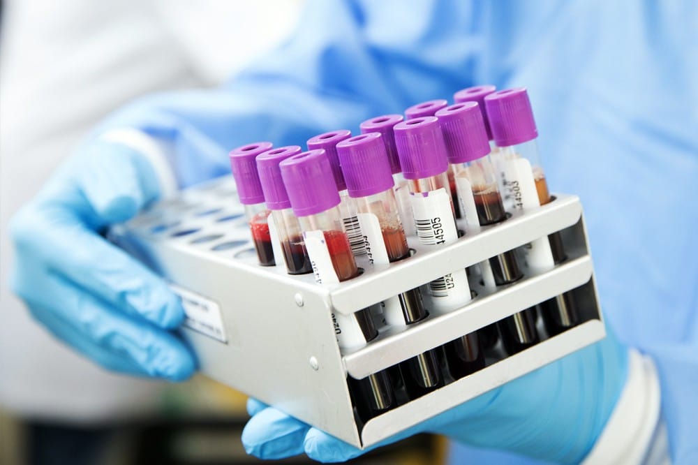 lab testing for common co occurring medical issues in autism photo 1